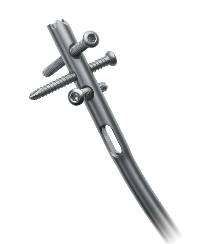 Sirus Tibial Nail — тибиальный гвоздь