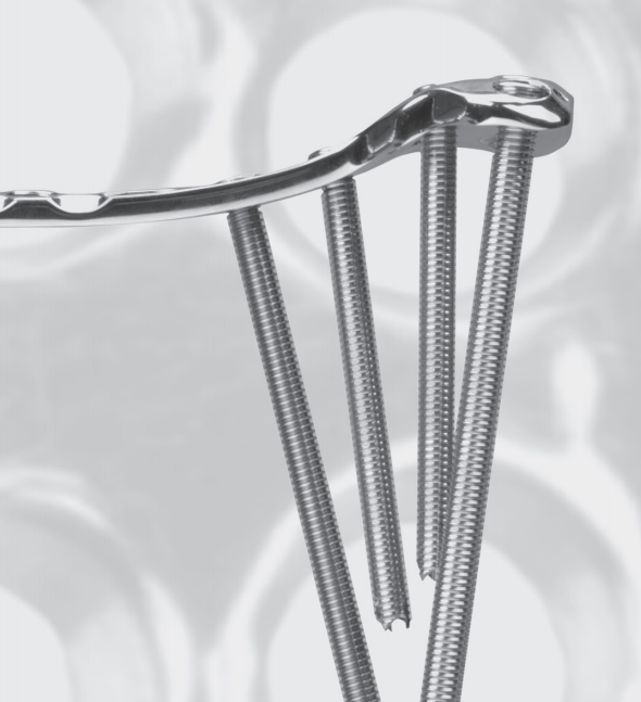 PLP — Proximal Tibia